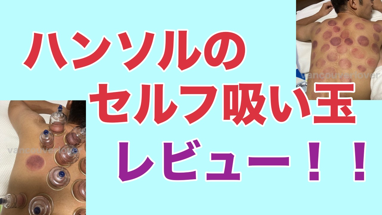 ハンソルのセルフ吸い玉レビュー 吸引力は強すぎて危険なレベル かえでブログ